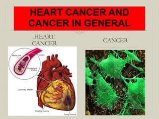 Heart cancer (1)