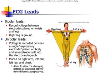 Copyright © The McGraw-Hill Companies, Inc. Permission required for reproduction or display.




             ECG Leads
   Bipolar leads:
       Record voltage between
        electrodes placed on wrists
        and legs.
       Right leg is ground.
   Unipolar leads:
       Voltage is recorded between
        a single “exploratory
        electrode” placed on body
        and an electrode built into
        the electrocardiograph.
       Placed on right arm, left arm,
        left leg, and chest.
            Allow to view the changing
             pattern of electrical activity
             from different perspectives.
 