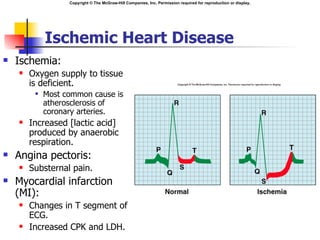 Copyright © The McGraw-Hill Companies, Inc. Permission required for reproduction or display.




             Ischemic Heart Disease
   Ischemia:
       Oxygen supply to tissue
        is deficient.
            Most common cause is
             atherosclerosis of
             coronary arteries.
       Increased [lactic acid]
        produced by anaerobic
        respiration.
   Angina pectoris:
       Substernal pain.
   Myocardial infarction
    (MI):
       Changes in T segment of
        ECG.
       Increased CPK and LDH.
 