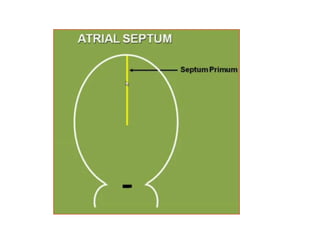 Here comes the role of endocardial cushion of AV canal
to close the ostium primum.
 