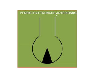 Conclusion
Part of heart to be separated Components of septa
Primitive atrium
(into Rt and Lt atrium)
Septum primum and septum
secundum
Bulboventricular cavity
(into Rt and Lt ventricle)
Muscular septum
Conal (Bulbar) septum
Membranous septum
Conus (outflow tract for both
ventricles)
conal septum (bulbar septum)
formed by conal ridges
Truncus Arteriosus (into
pulmonary trunk and ascending
aorta)
spiral septum (Aortico-
pulmonary septum) by a pair of
truncal ridges
 