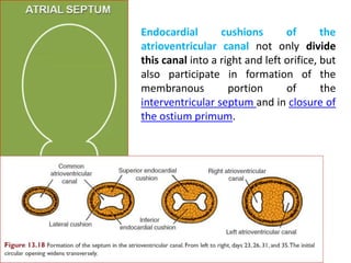 Septum primum
Sickle shaped crest
arising from roof of
common atrium into
the lumen.
Ostium primum
 