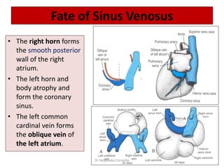Fate of Sinus Venosus
• The right horn forms
the smooth posterior
wall of the right
atrium.
• The left horn and
body atrophy and
form the coronary
sinus.
• The left common
cardinal vein forms
the oblique vein of
the left atrium.
Dr Ndayisaba Corneille
 