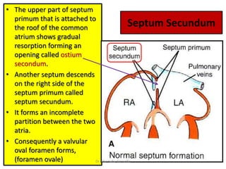 Septum Secundum
• The upper part of septum
primum that is attached to
the roof of the common
atrium shows gradual
resorption forming an
opening called ostium
secondum.
• Another septum descends
on the right side of the
septum primum called
septum secundum.
• It forms an incomplete
partition between the two
atria.
• Consequently a valvular
oval foramen forms,
(foramen ovale) Dr Ndayisaba Corneille
 