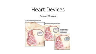Heart Devices
Samuel Moreno
 