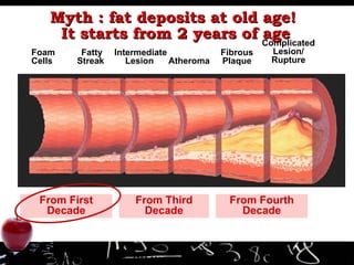 Myth : fat deposits at old age!  It starts from 2 years of age Foam Cells  Fatty Streak  Intermediate Lesion  Atheroma Fibrous Plaque Complicated Lesion/ Rupture Adapted from Pepine CJ.  Am J Cardio.  1998;82(suppl 104). From First Decade From Third Decade From Fourth Decade 