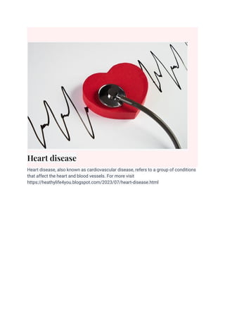 Heart disease
Heart disease, also known as cardiovascular disease, refers to a group of conditions
that affect the heart and blood vessels. For more visit
https://heathylife4you.blogspot.com/2023/07/heart-disease.html
 