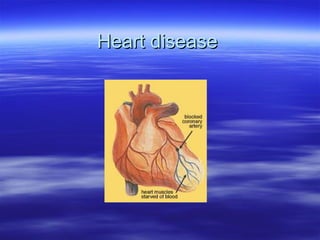 Heart disease

 