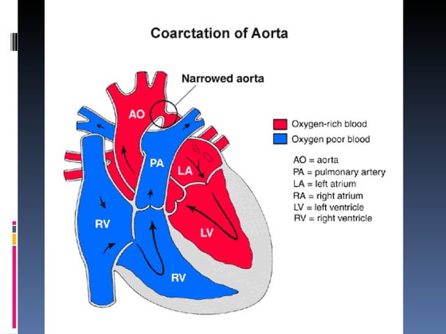 Classification Of Heart Disease In Pregnancy classification-of-heart-disease-in-pregnancy