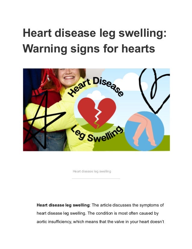 Heart disease leg swelling:
Warning signs for hearts
Heart disease leg swelling
Heart disease leg swelling: The article discusses the symptoms of
heart disease leg swelling. The condition is most often caused by
aortic insufficiency, which means that the valve in your heart doesn’t
 