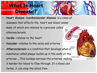 What Is Heart
     Disease?
• Heart disease /cardiovascular disease is a class of
  diseases that affects the heart and blood vessel
  many of which are related to a process called
  atherosclerosis.

• Cardio –relates to the heart

• Vascular –relates to the veins and arteries

• Atherosclerosis is a condition that develops when a
  substance called plaque builds up in the walls of the
  arteries   This buildup narrows the arteries, making
  it harder for blood to flow through. If a blood clot
  forms, it can stop the blood flow.
 