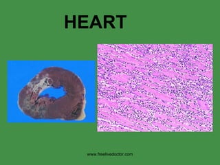 HEART www.freelivedoctor.com 
