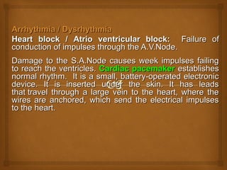 Arrhythmia / DysrhythmiaArrhythmia / Dysrhythmia
Heart blockHeart block // Atrio ventricular block:Atrio ventricular block: Failure ofFailure of
conduction of impulses through the A.V.Node.conduction of impulses through the A.V.Node.
Damage to the S.A.Node causes week impulses failingDamage to the S.A.Node causes week impulses failing
to reach the ventricles.to reach the ventricles. Cardiac pacemakerCardiac pacemaker establishesestablishes
normal rhythm.normal rhythm. It is a small, battery-operated electronicIt is a small, battery-operated electronic
device. It is inserted under the skin. It has leadsdevice. It is inserted under the skin. It has leads
that travel through a large vein to the heart, where thethat travel through a large vein to the heart, where the
wires are anchored, which send the electrical impulseswires are anchored, which send the electrical impulses
to the heart.to the heart.
 
