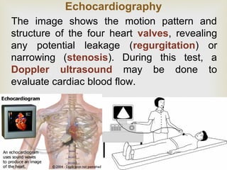 Echocardiography
The image shows the motion pattern and
structure of the four heart valves, revealing
any potential leakage (regurgitation) or
narrowing (stenosis). During this test, a
Doppler ultrasound may be done to
evaluate cardiac blood flow.
 