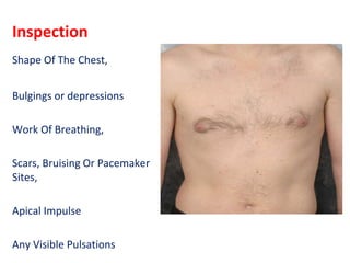 Inspection
Shape Of The Chest,
Bulgings or depressions
Work Of Breathing,
Scars, Bruising Or Pacemaker
Sites,
Apical Impulse
Any Visible Pulsations
 