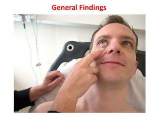 General Findings
 