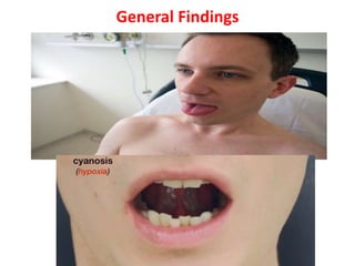 General Findings
 