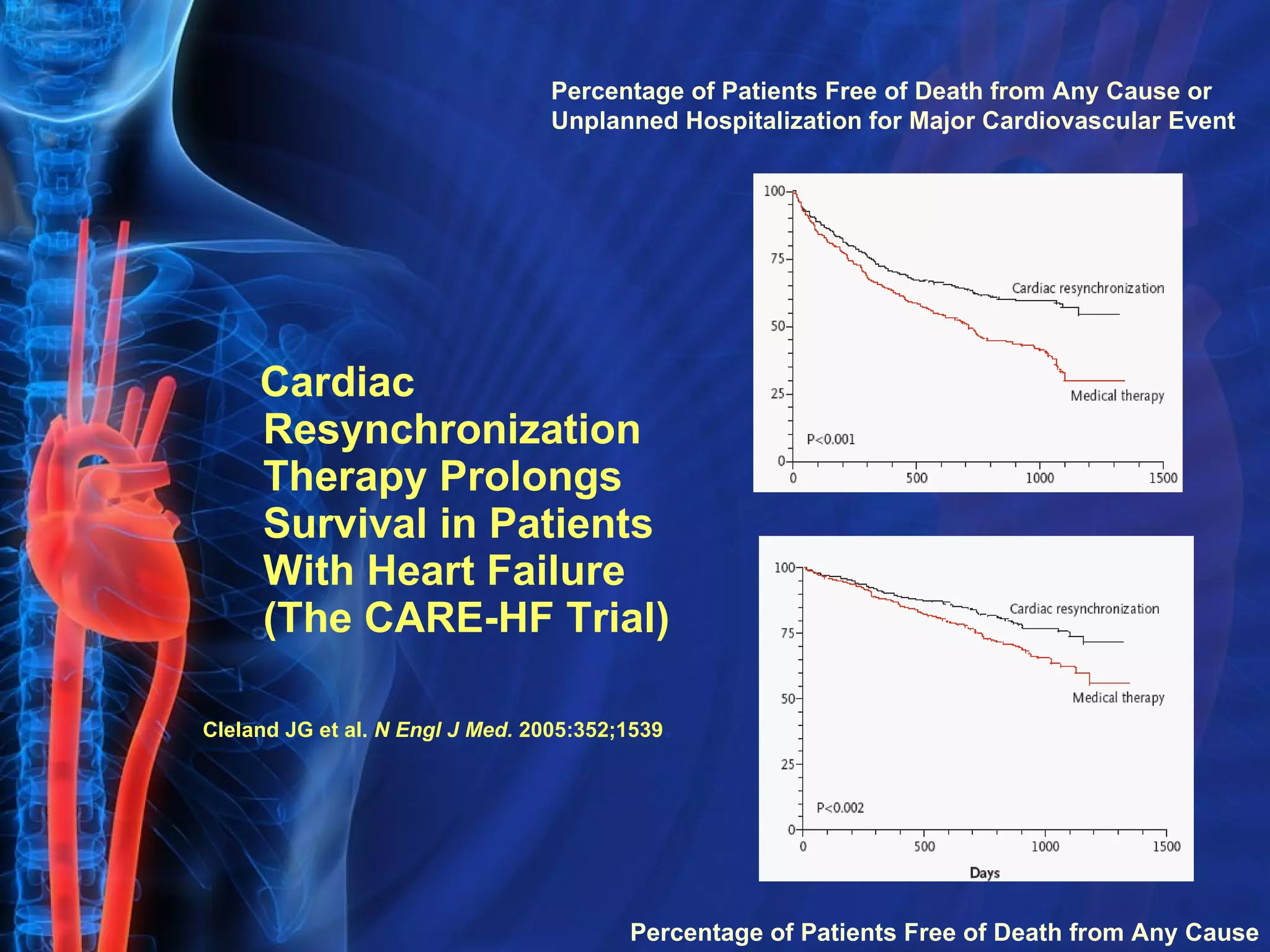 Cardiac Resynchronization Therapy Prolongs Survival in Patients With Heart Failure  (The CARE-HF Trial) Percentage of Patients Free of Death from Any Cause or  Unplanned Hospitalization for Major Cardiovascular Event Percentage of Patients Free of Death from Any Cause Cleland JG et al.  N Engl J Med.  2005:352;1539 . 