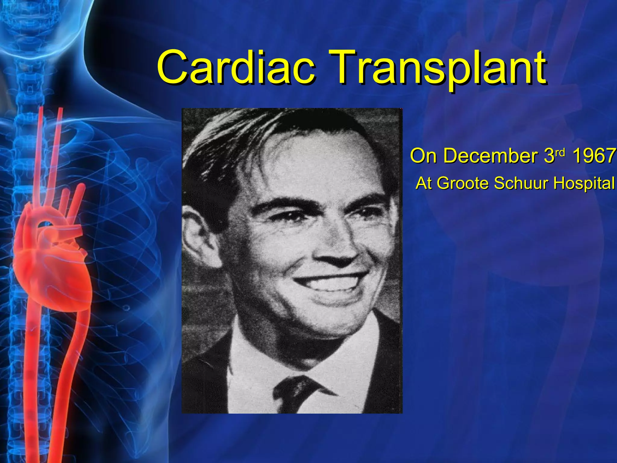 Cardiac Transplant At Groote Schuur Hospital  On December 3 rd  1967  