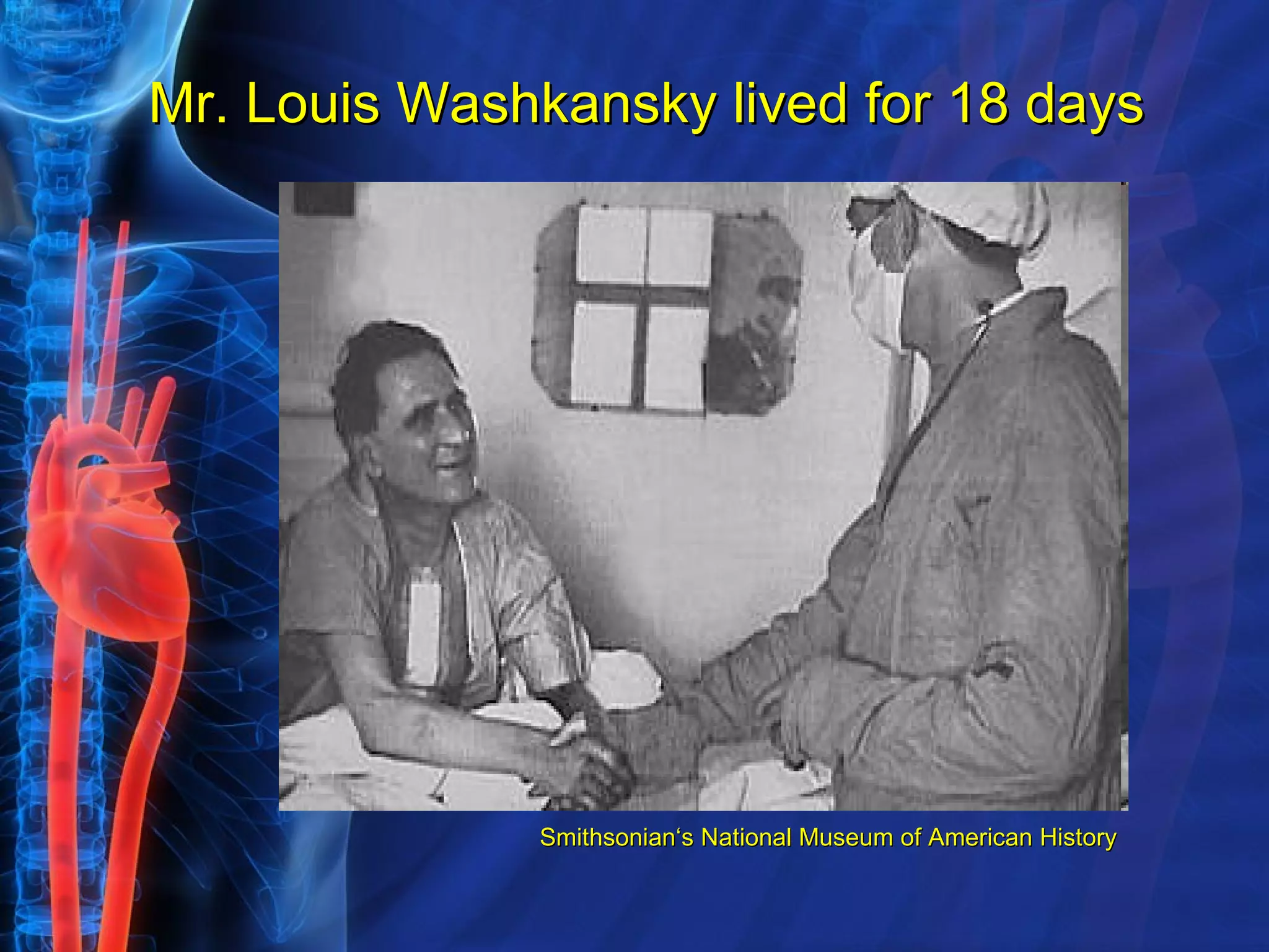 Mr. Louis Washkansky lived for 18 days    Smithsonian‘s National Museum of American History 