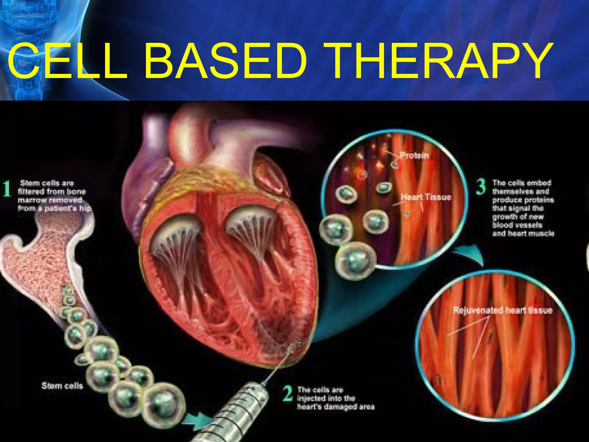 CELL BASED THERAPY 