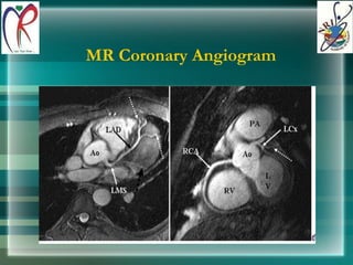 MR Coronary Angiogram 