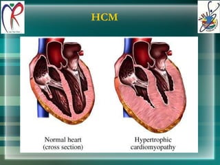 HCM 