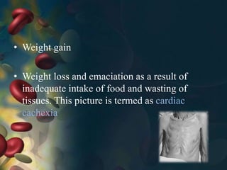 • Weight gain
• Weight loss and emaciation as a result of
inadequate intake of food and wasting of
tissues. This picture is termed as cardiac
cachexia
 