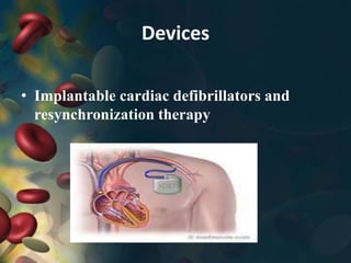 Devices
• Implantable cardiac defibrillators and
resynchronization therapy
 