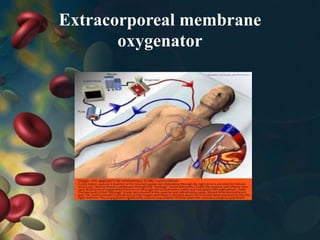 Extracorporeal membrane
oxygenator
 