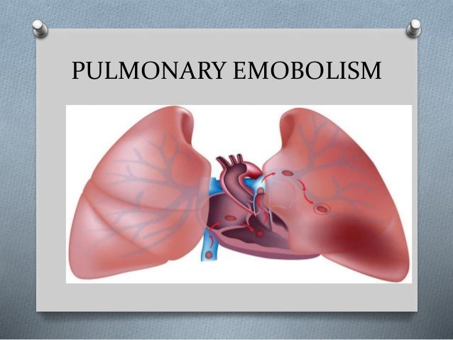 Coronary Bypass Surgery And Lasix