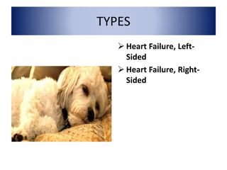TYPES
 Heart Failure, Left-
Sided
 Heart Failure, Right-
Sided
 
