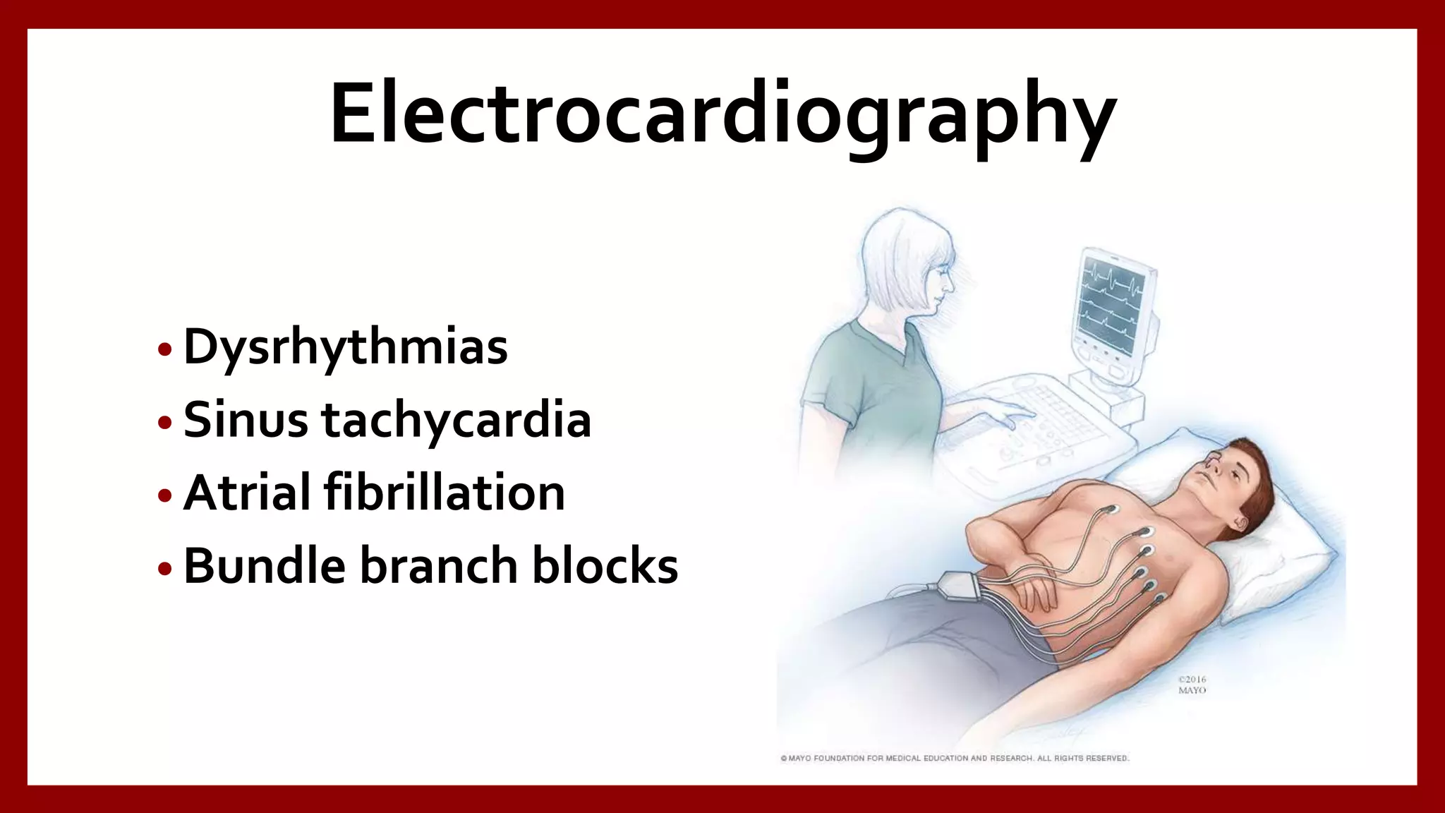 Electrocardiography
• Dysrhythmias
• Sinus tachycardia
• Atrial fibrillation
• Bundle branch blocks
 
