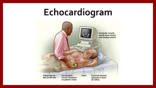 Echocardiogram
 