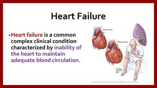 Heart Failure
•Heart failure is a common
complex clinical condition
characterized by inability of
the heart to maintain
adequate blood circulation.
 