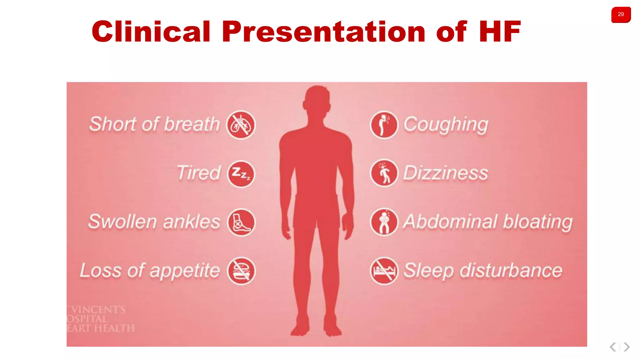 29
Clinical Presentation of HF
 