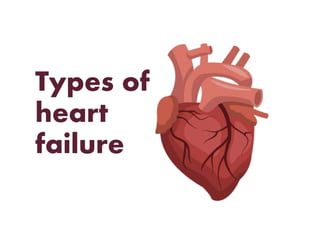 Types of
heart
failure
 