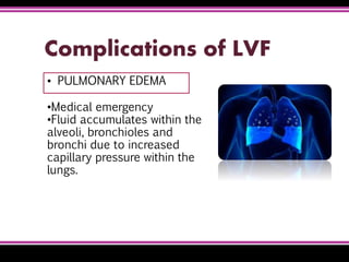 Complications of LVF
▪ PULMONARY EDEMA
•Medical emergency
•Fluid accumulates within the
alveoli, bronchioles and
bronchi due to increased
capillary pressure within the
lungs.
 
