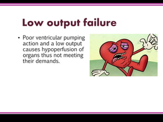Low output failure
▪ Poor ventricular pumping
action and a low output
causes hypoperfusion of
organs thus not meeting
their demands.
 