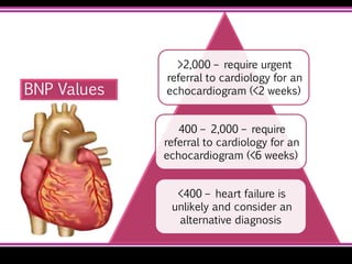 >2,000 – require urgent
referral to cardiology for an
echocardiogram (<2 weeks)
400 – 2,000 – require
referral to cardiology for an
echocardiogram (<6 weeks)
<400 – heart failure is
unlikely and consider an
alternative diagnosis
BNP Values
 