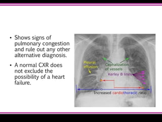 ▪ Shows signs of
pulmonary congestion
and rule out any other
alternative diagnosis.
▪ A normal CXR does
not exclude the
possibility of a heart
failure.
 