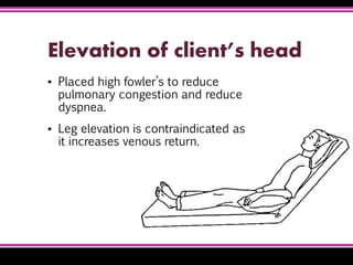 Elevation of client’s head
▪ Placed high fowler’s to reduce
pulmonary congestion and reduce
dyspnea.
▪ Leg elevation is contraindicated as
it increases venous return.
 