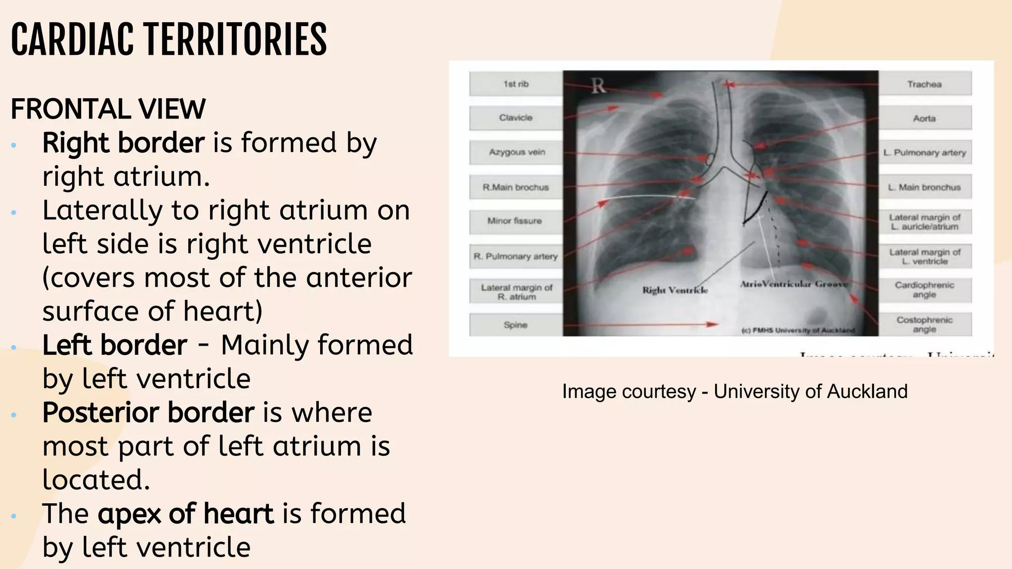 CARDIAC TERRITORIES
FRONTAL VIEW
• Right border is formed by
right atrium.
• Laterally to right atrium on
left side is right ventricle
(covers most of the anterior
surface of heart)
• Left border - Mainly formed
by left ventricle
• Posterior border is where
most part of left atrium is
located.
• The apex of heart is formed
by left ventricle
Image courtesy - University of Auckland
 