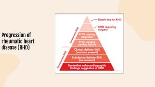 Progression of
rheumatic heart
disease (RHD)
 