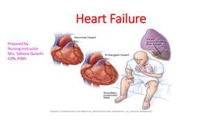 Heart Failure
Prepared by
Nursing Instructor
Mrs. Safoora Qureshi
CON, PIMS
 