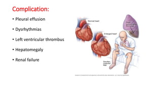 Complication:
• Pleural effusion
• Dysrhythmias
• Left ventricular thrombus
• Hepatomegaly
• Renal failure
 