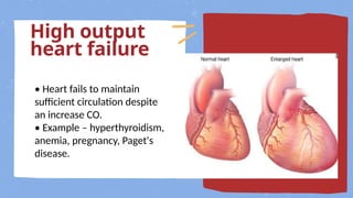 heart failure for nursing student of anesthesia techniques department ...