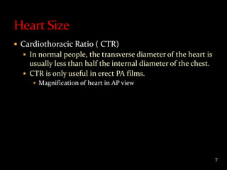 Heart failure radiology group1 year 5 10-11 | PPTX