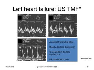 Left heart failure: US TMF*
             A                  B




             C                 A normal transmitral filling

                               B early diastolic dysfunction

                               C progredient diastolic
                               Dysfunction
                                                               *Transmitral flow
                               DT deceleration time


March 2013       ghennersdorf DGK ESC SES                               20
 