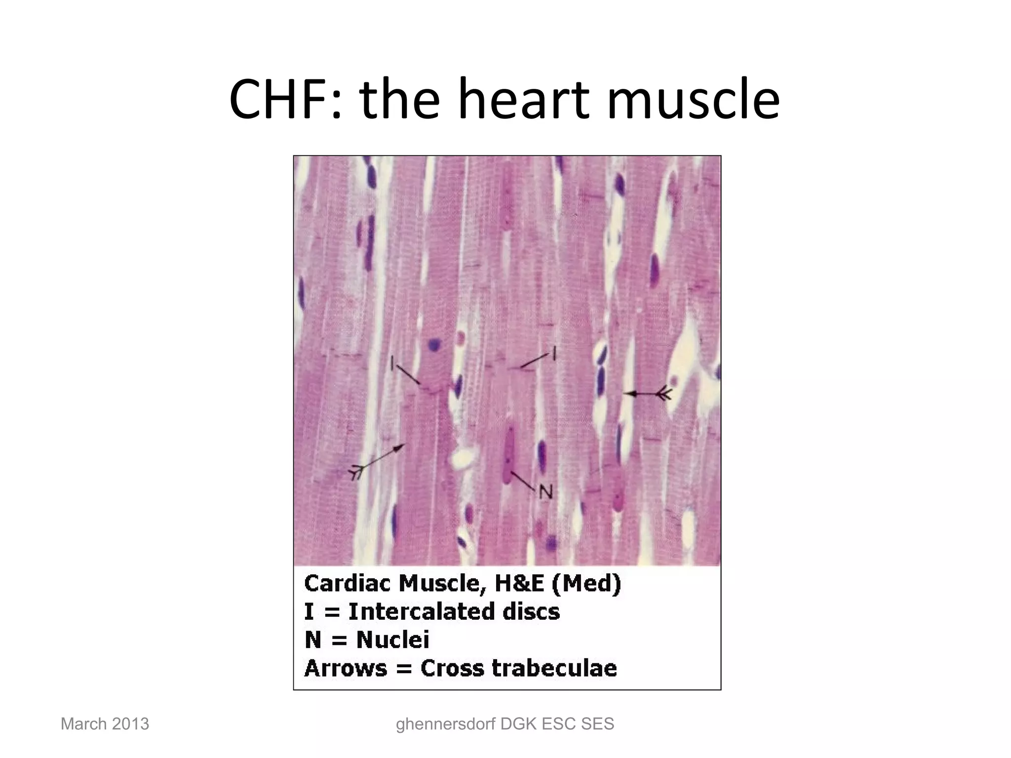 CHF: the heart muscle




March 2013         ghennersdorf DGK ESC SES
 